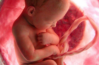 Planned Parenthood endorses post-birth abortion