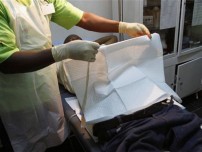 Why did this man get circumcised at 64 years old?